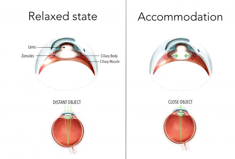 A diagram of relaxed and accomodated lenses.